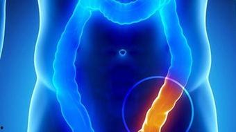 做息肉视频,微创治疗新视角